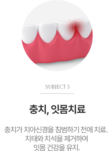 충치, 잇몸치료
