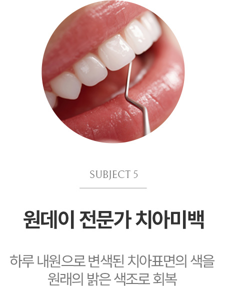 원데이 전문가 치아미백