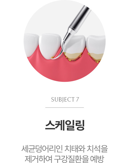 스케일링