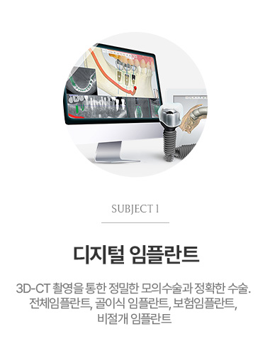 디지털 임플란트