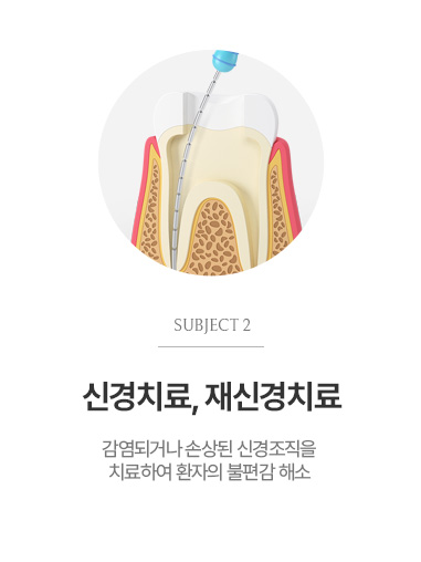신경치료, 재신경치료