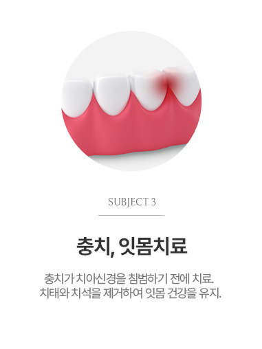 충치, 잇몸치료